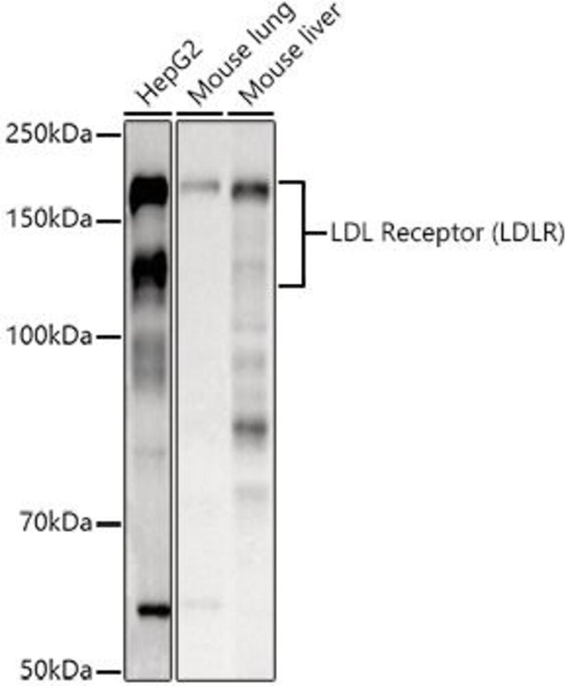 Anti-LDL Receptor Antibody, 100 µl - Luminix Health