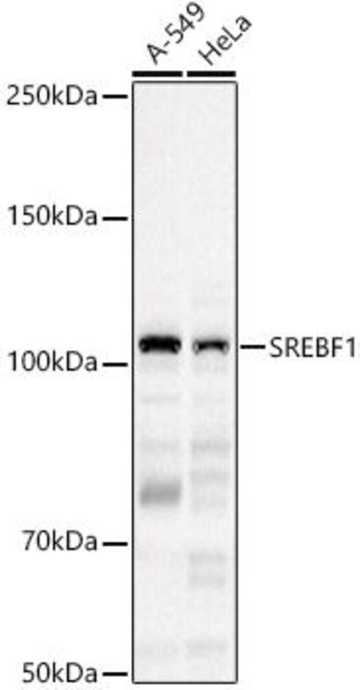 Anti-SREBP1 Antibody, 100 µl - Luminix Health