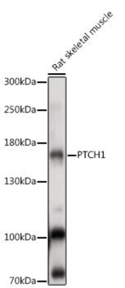 Anti-Patched / PTCH1 Antibody, 100 µl - Luminix Health