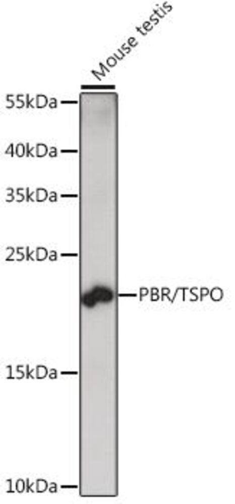 Anti-PBR Antibody, 100 µl - Luminix Health