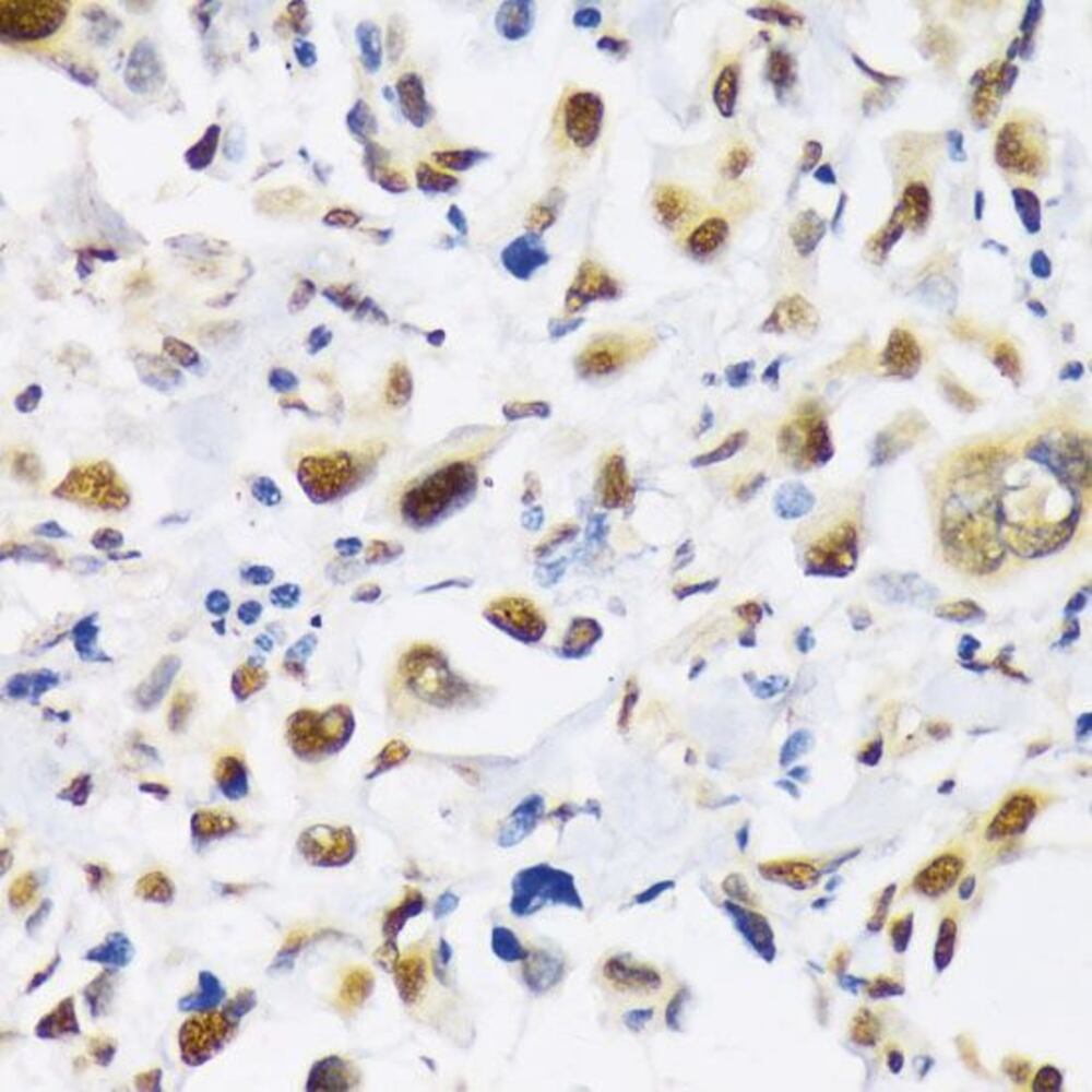 Anti-KAT3B / p300 Antibody, 100 µl - Luminix Health
