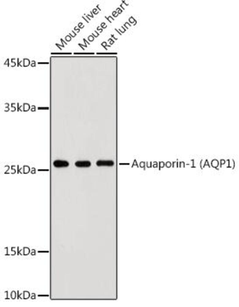 Anti-Aquaporin 1 Antibody, 100 µl - Luminix Health