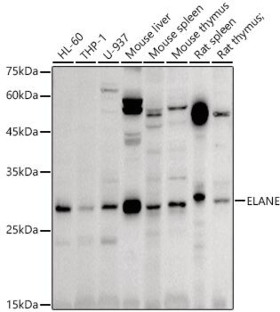 Anti-Neutrophil Elastase Antibody, 100 µl - Luminix Health