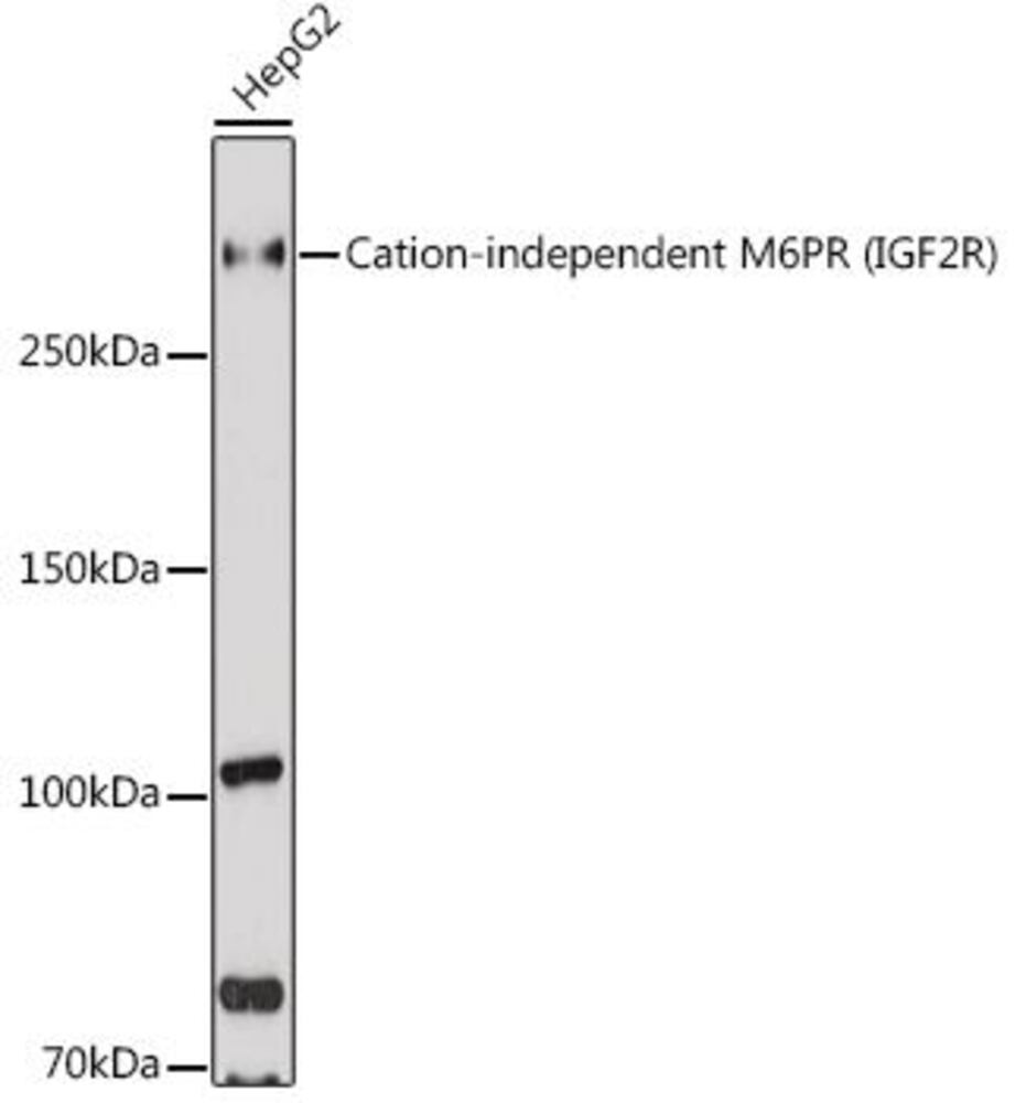Anti-M6PR (cation independent) Antibody, 100 µl - Luminix Health