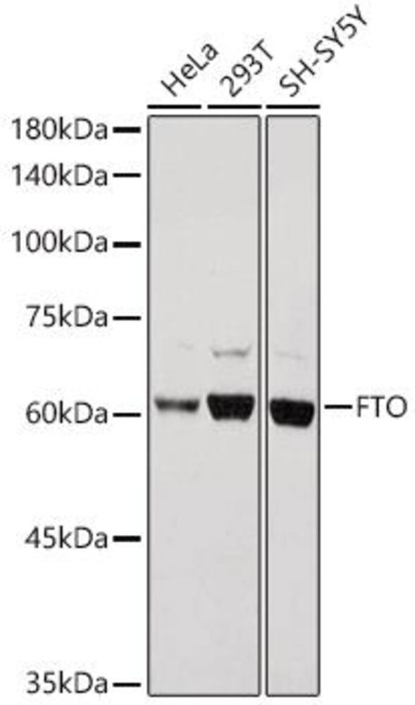 Anti-FTO Antibody, 100 µl - Luminix Health