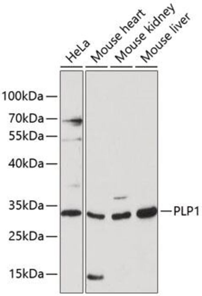 Anti-Myelin PLP Antibody, Density (D) 1 g/cm³, Storage temp. +4 °C - Luminix Health