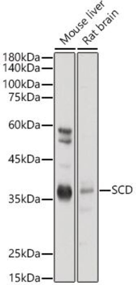 Anti-SCD1 Antibody, 100 µl - Luminix Health