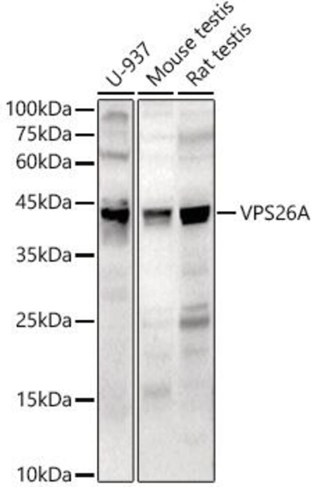 Anti-VPS26 Antibody, 100 µl - Luminix Health