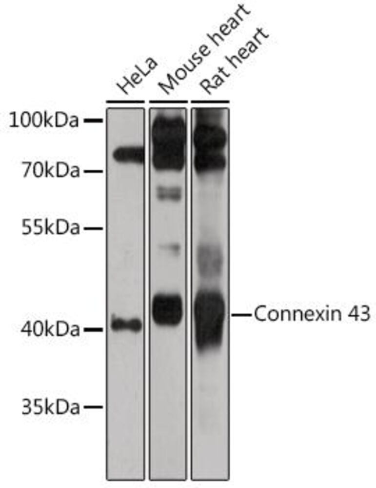 Anti-Connexin 43 / GJA1 Antibody - Luminix Health
