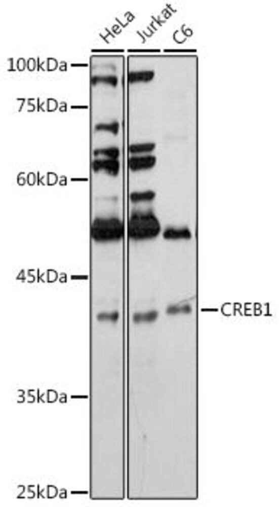Anti-CREB Antibody, 100 µl - Luminix Health