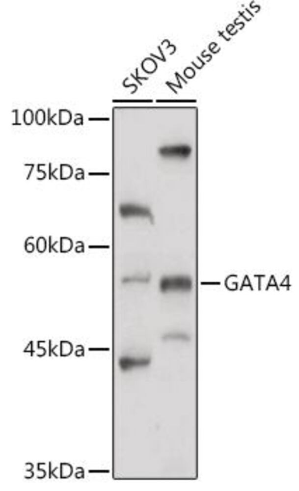 Anti-GATA4 Antibody, 100 µl - Luminix Health