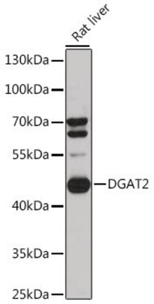 Anti-DGAT2 Antibody, 100 µl - Luminix Health