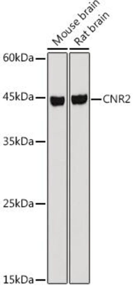 Anti-Cannabinoid Receptor II Antibody, 100 µl - Luminix Health