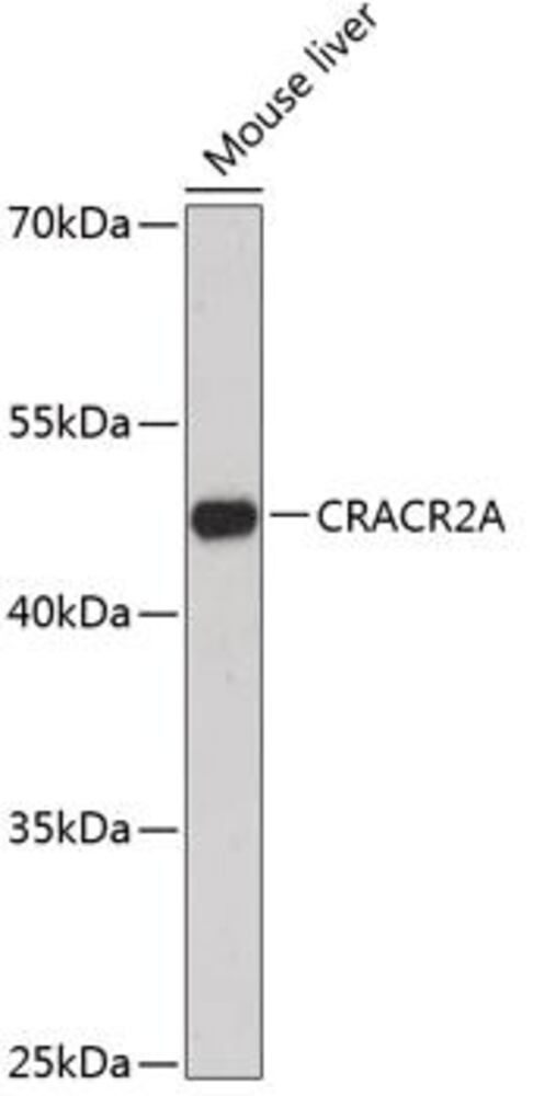 Anti-CRACR2A Antibody, Density (D) 1 g/cm³, Storage temp. +4 °C - Luminix Health