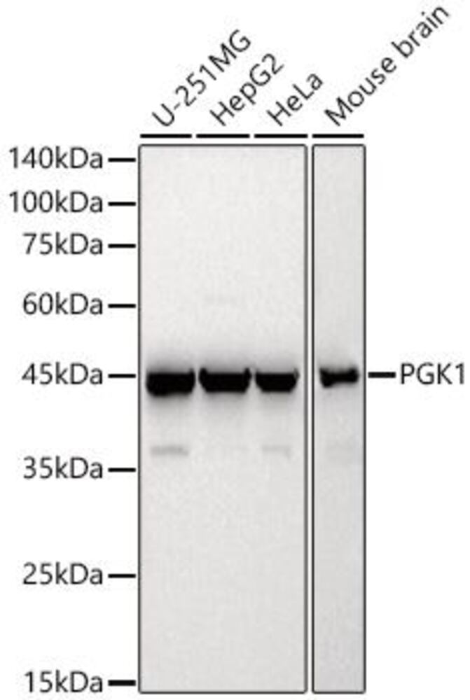 Anti-PGK1 Antibody, 100 µl - Luminix Health
