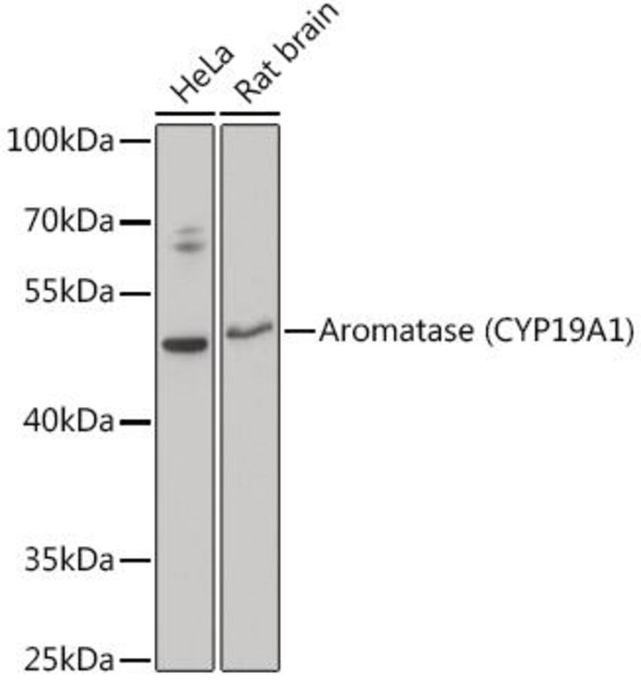 Anti-Aromatase Antibody, 100 µl - Luminix Health
