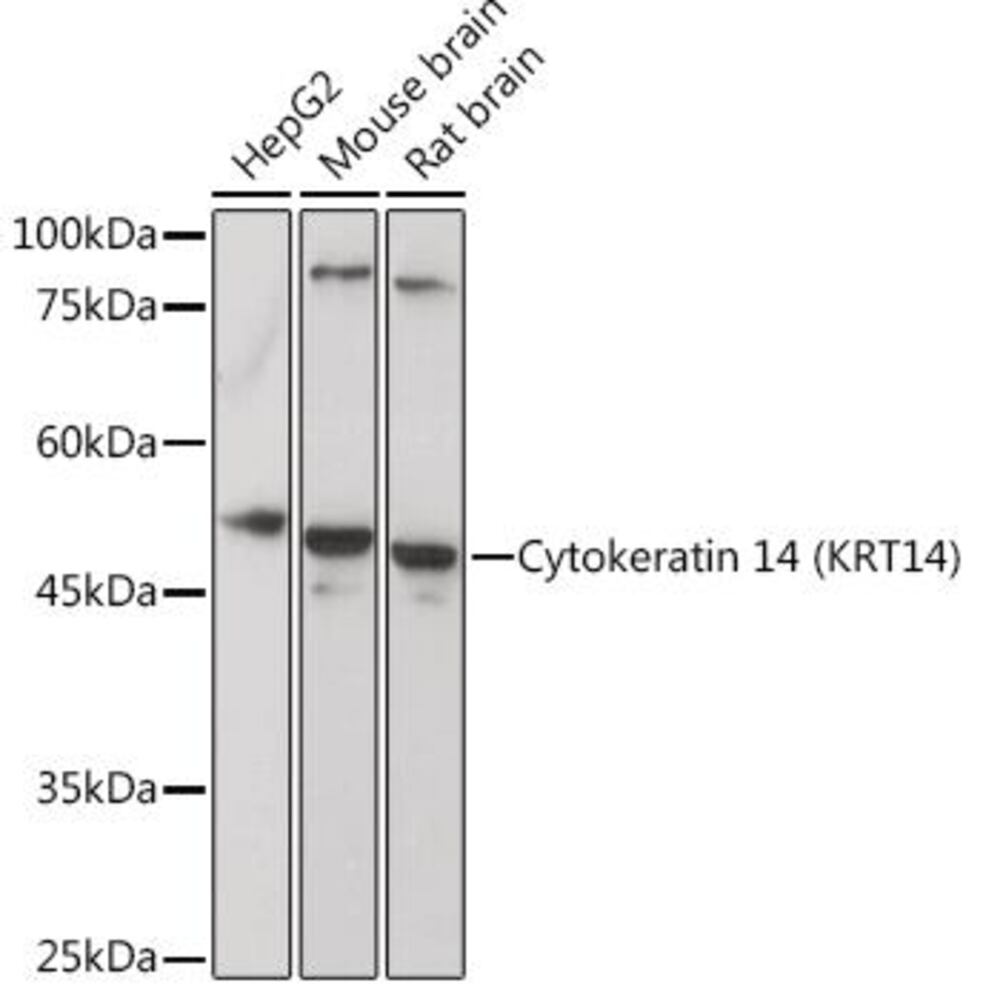Anti-Cytokeratin 14 Antibody, 100 µl - Luminix Health