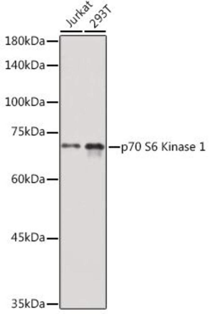 Anti-S6K1 Antibody, 100 µl - Luminix Health