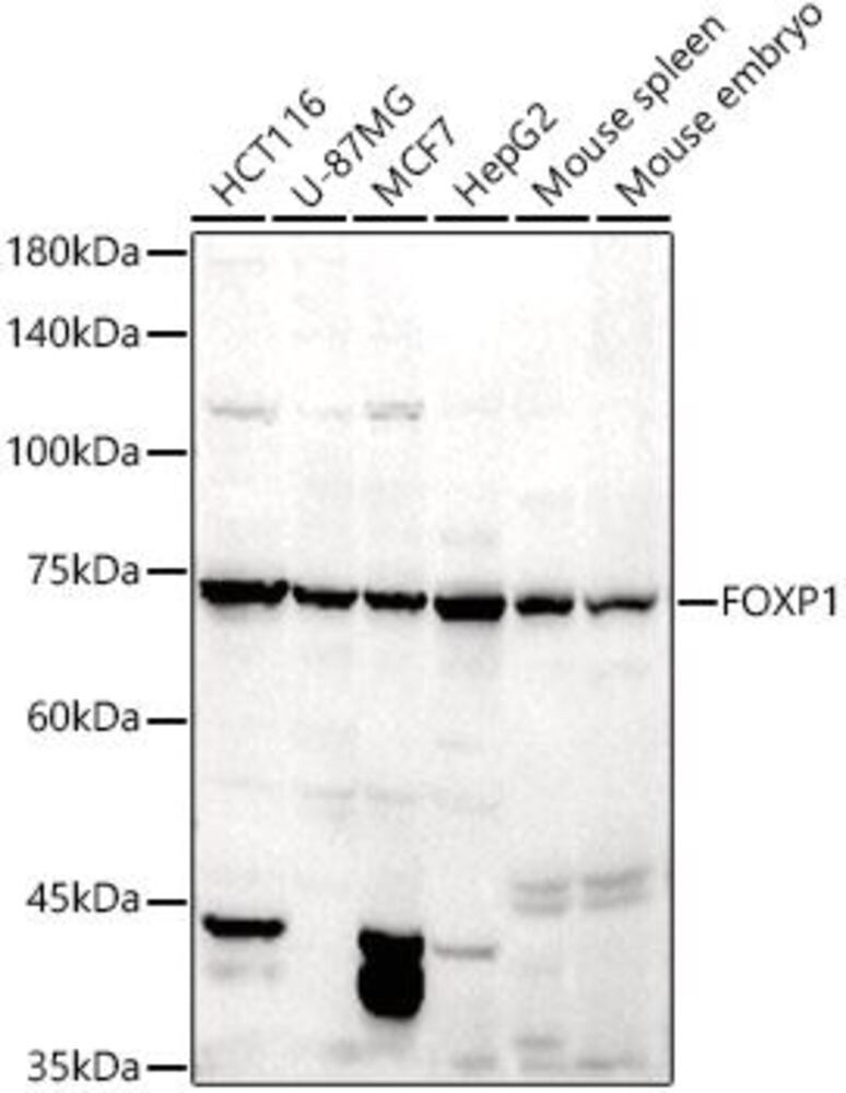 Anti-FOXP1 Antibody, 100 µl - Luminix Health