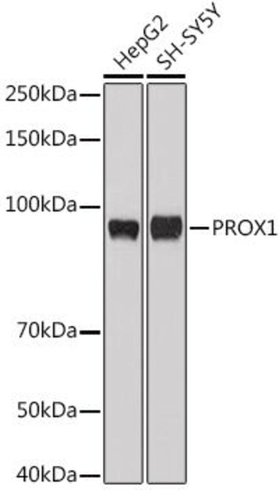 Anti-PROX1 Antibody, 100 µl - Luminix Health