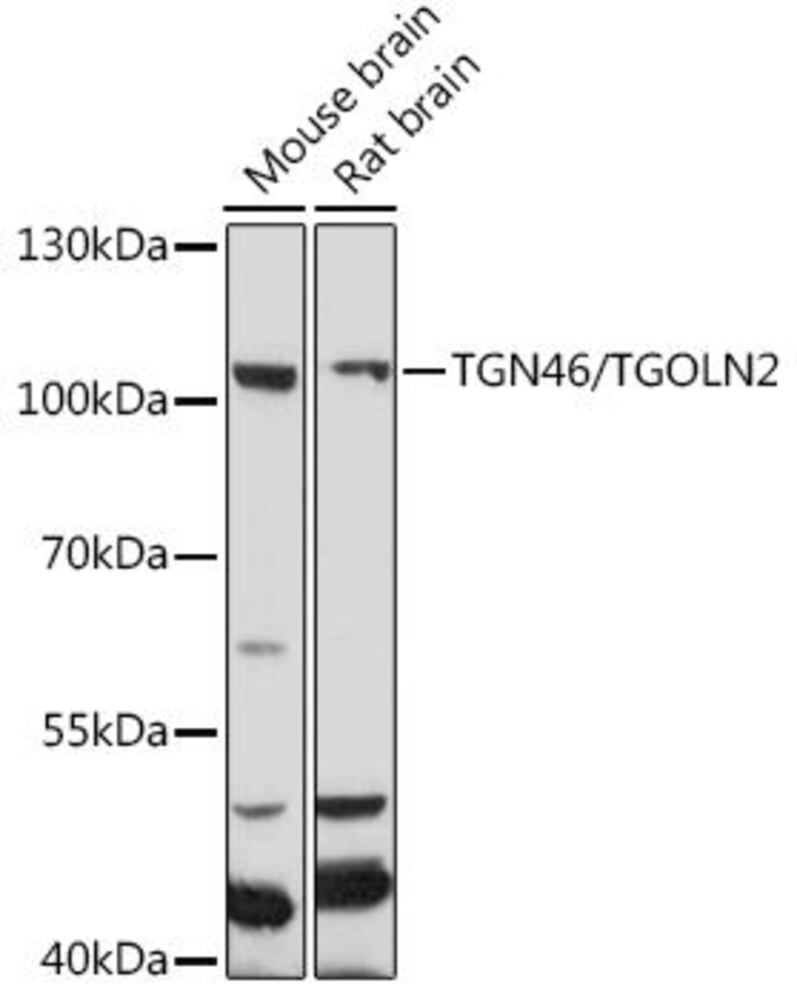 Anti-TGN46 Antibody, 100 µl - Luminix Health