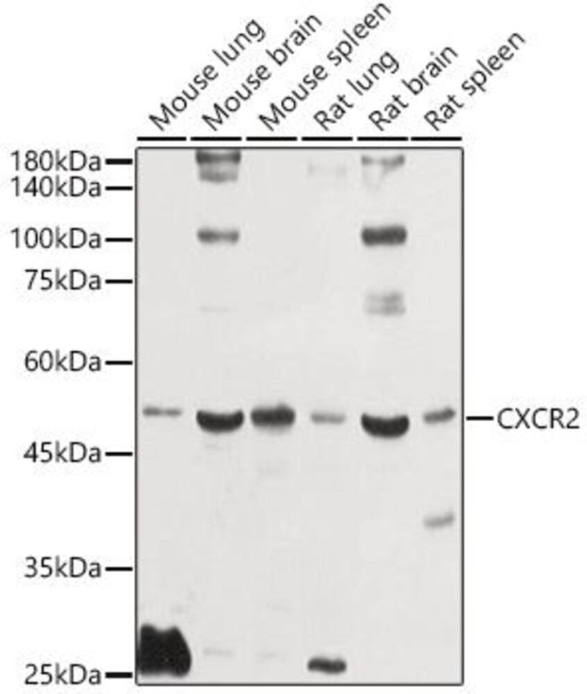 Anti-CXCR2 Antibody, 100 µl - Luminix Health
