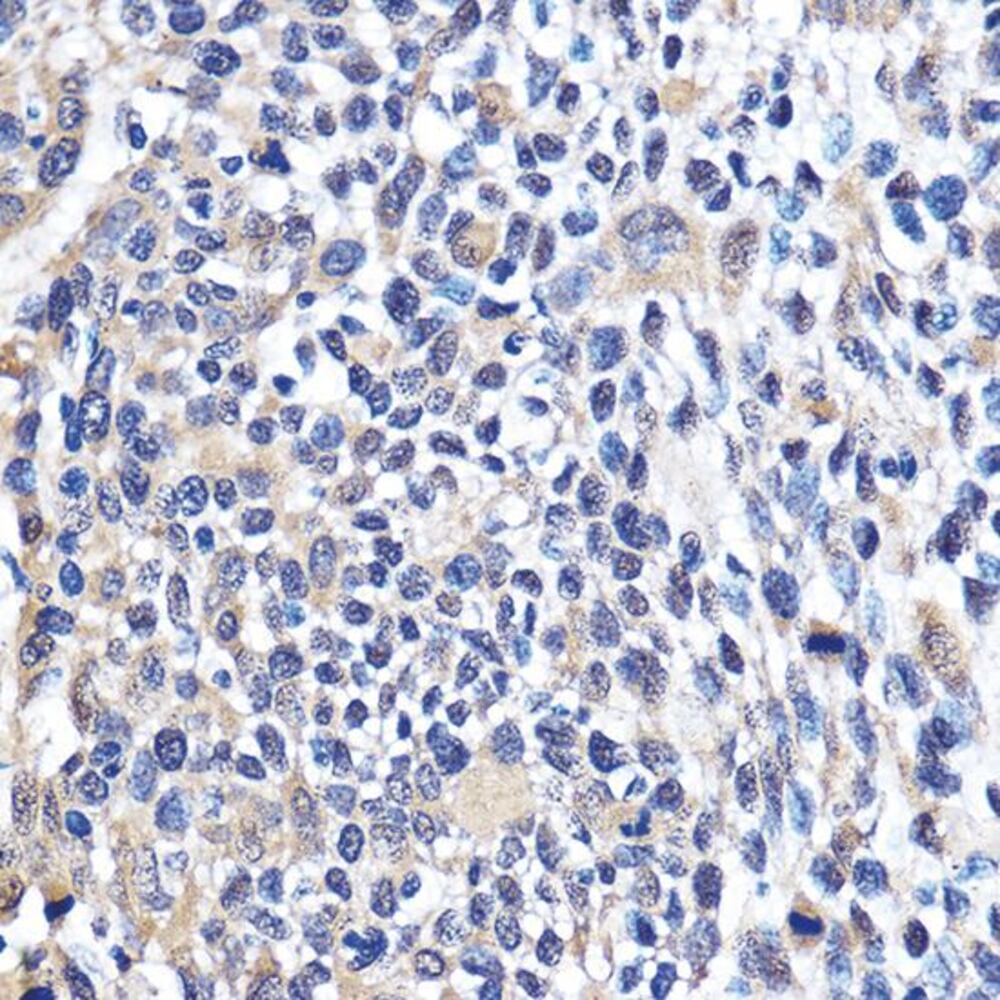 Anti-Cdk6 Antibody, 100 µl - Luminix Health
