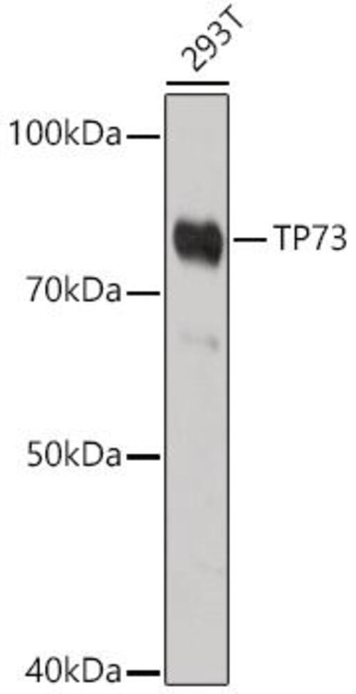 Anti-p73 Antibody, 100 µl - Luminix Health