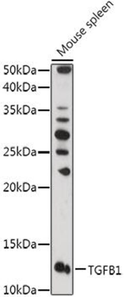 Anti-TGF beta 1 Antibody, 100 µl - Luminix Health