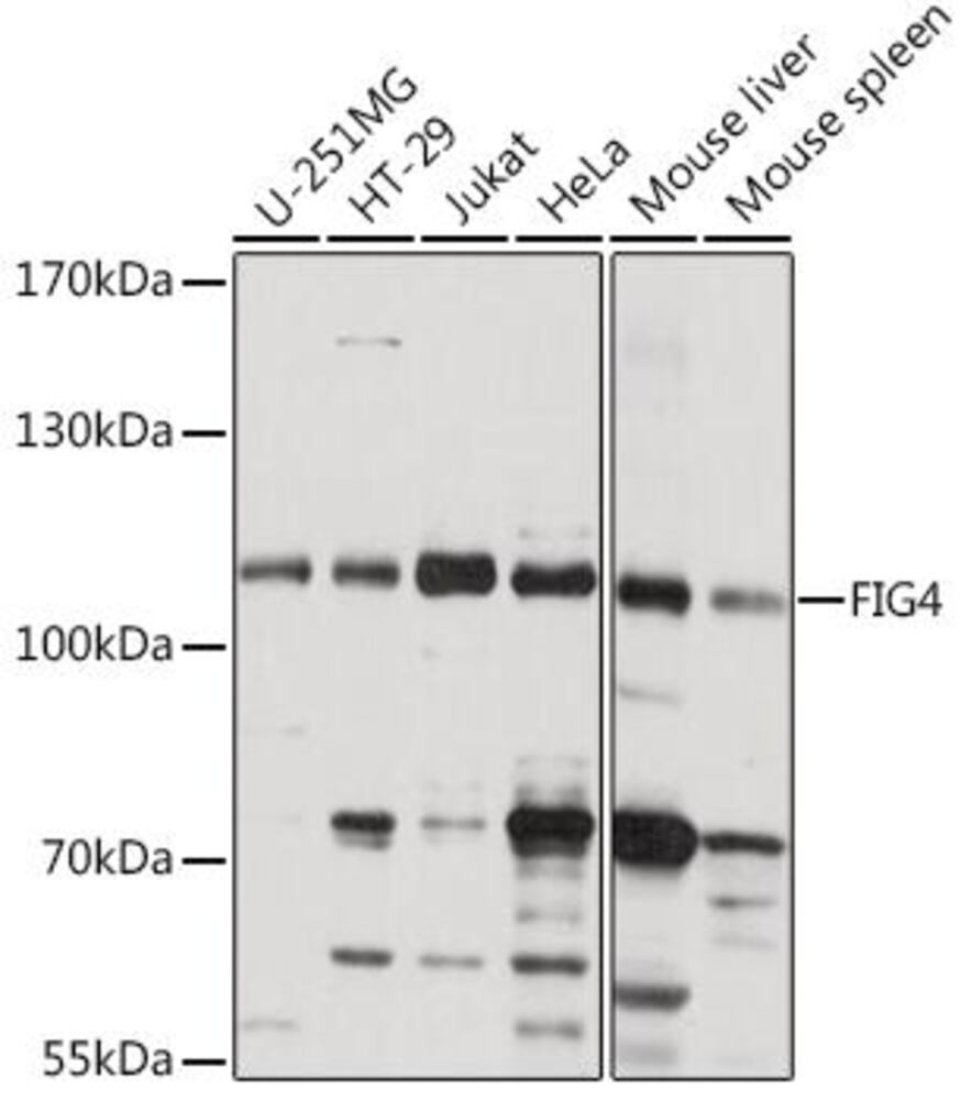 Anti-FIG4 Antibody, 100 µl - Luminix Health