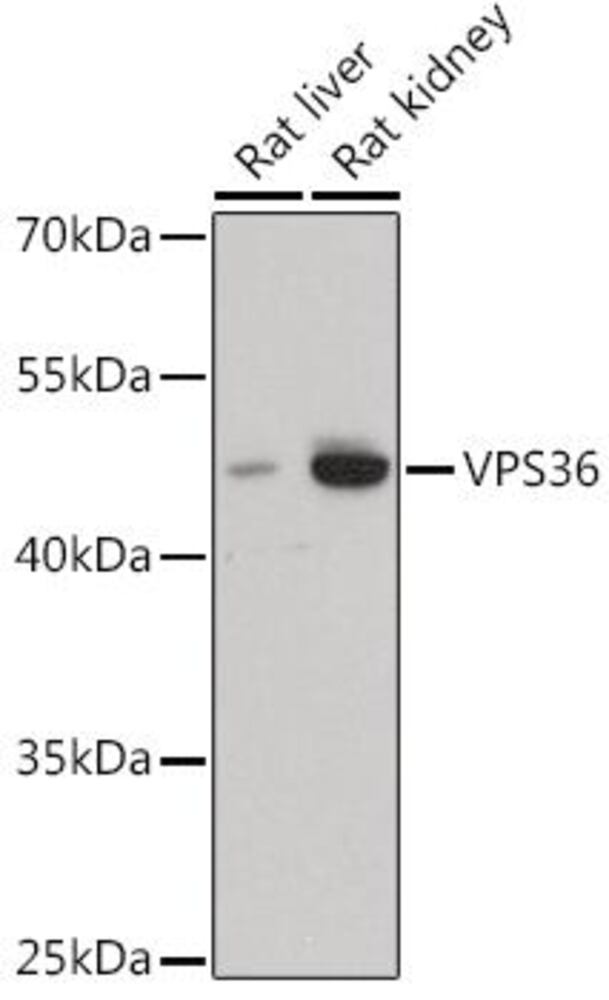 Anti-VPS36 Antibody, 100 µl - Luminix Health