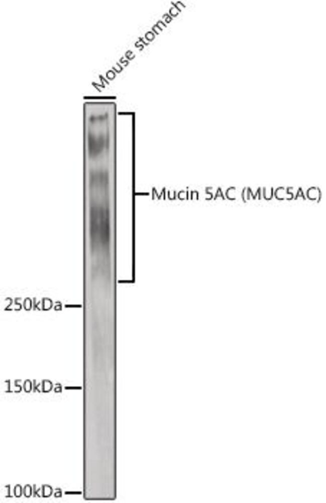 Anti-Mucin 5AC Antibody, 100 µl - Luminix Health
