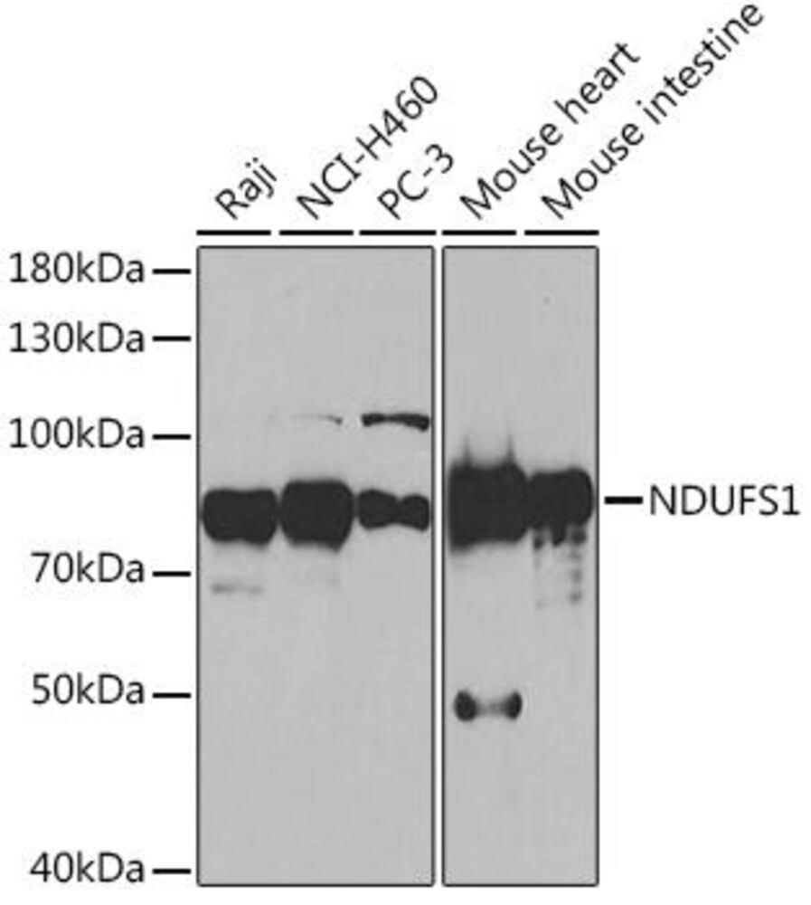 Anti-Ndufs1 Antibody, 100 µl - Luminix Health