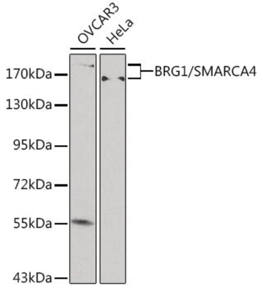 Anti-BRG1 Antibody, 100 µl - Luminix Health