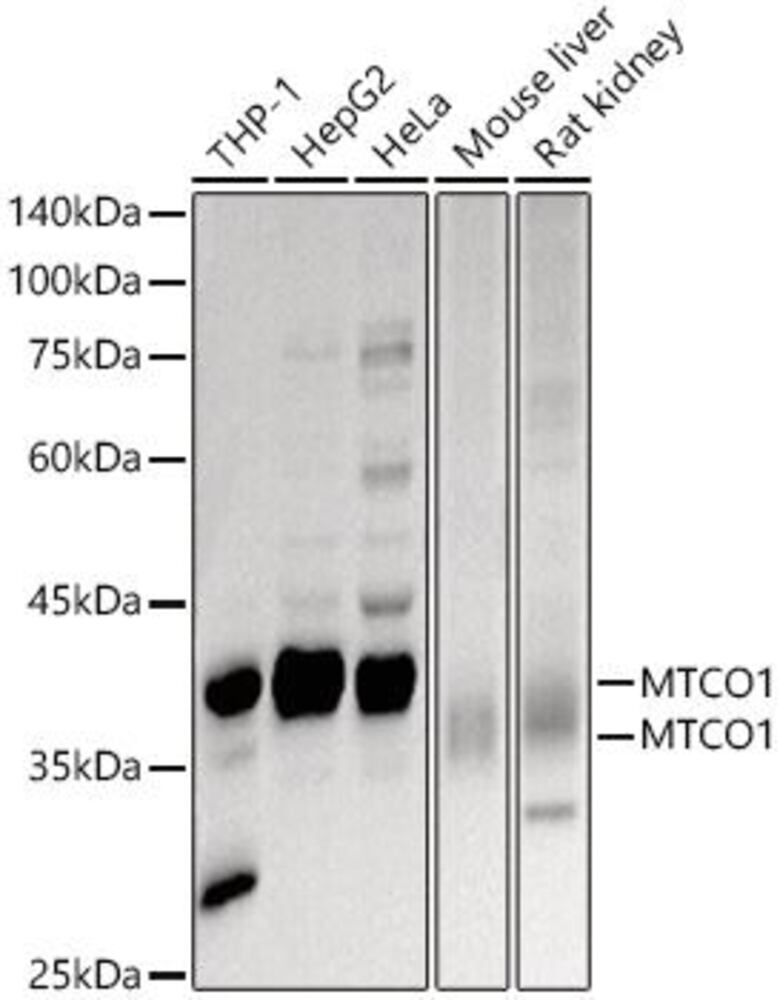 Anti-MTCO1 Antibody, 100 µl - Luminix Health