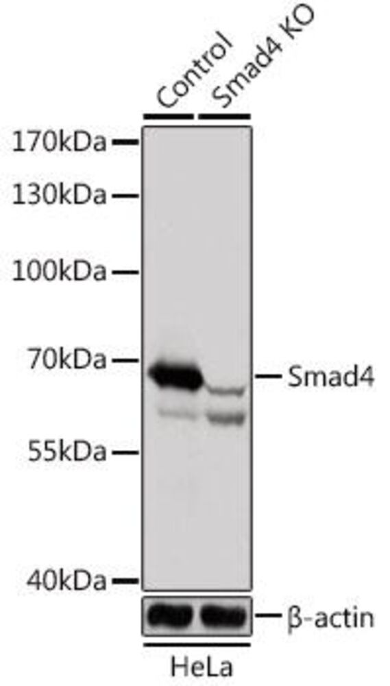 Anti-Smad4 Antibody, 100 µl - Luminix Health