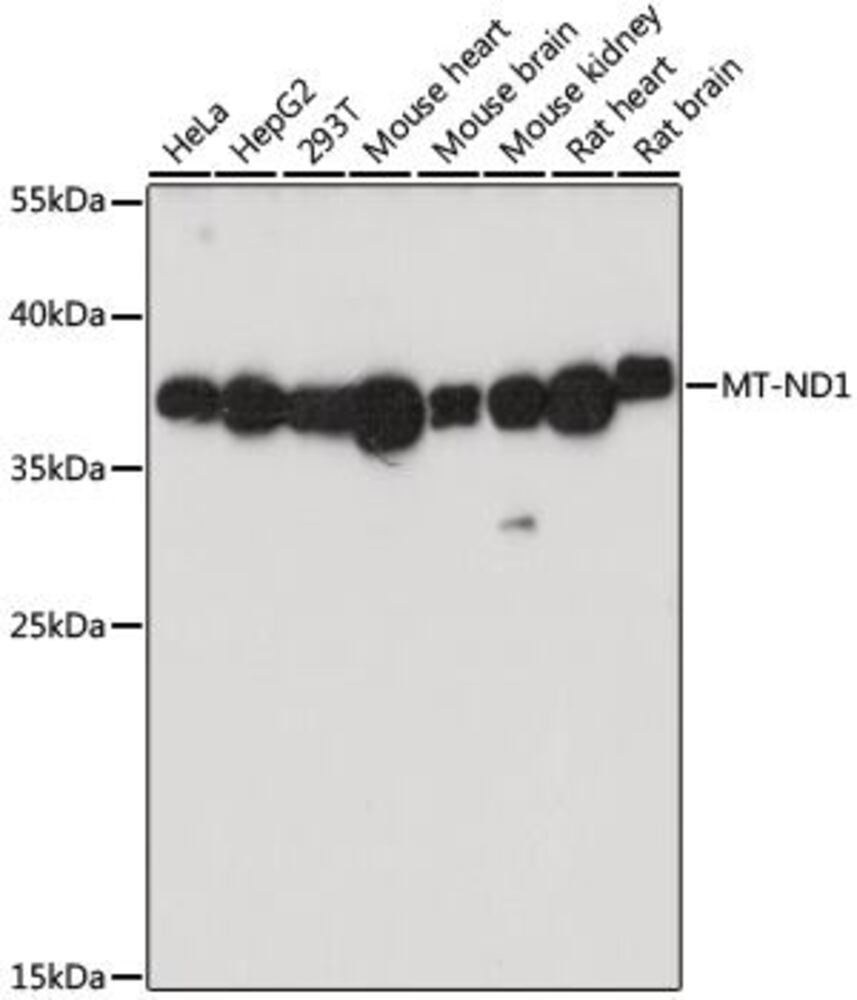 Anti-MT-ND1 Antibody, 100 µl - Luminix Health