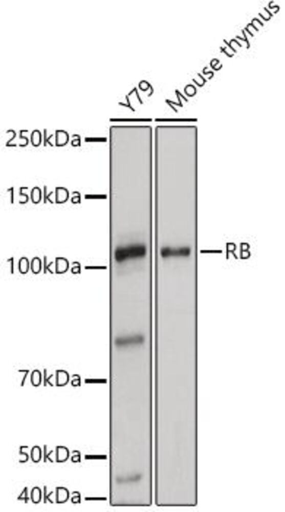 Anti-Rb Antibody, 100 µl - Luminix Health
