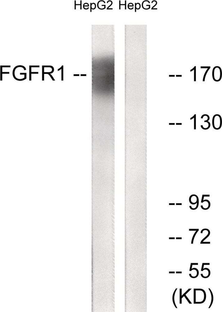 Anti-FGFR1 Antibody, 100 µg - Luminix Health