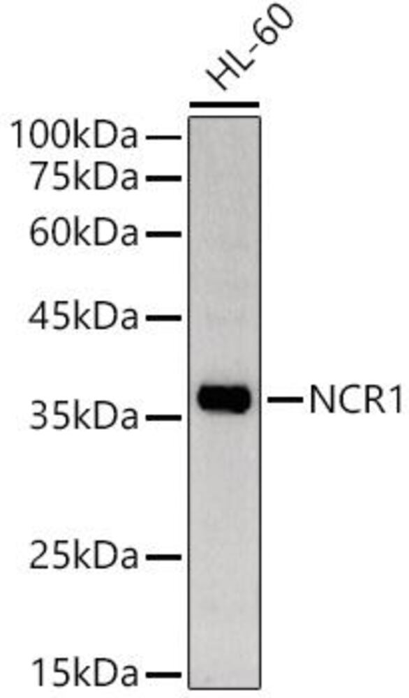 Anti-NCR1 Antibody, 100 µl - Luminix Health