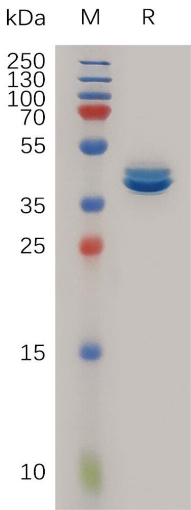 Recombinant Human MCP1 Protein (Fc Tag), 50 µg - Luminix Health