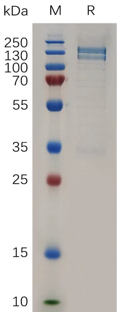 Recombinant Human RON Protein (Fc Tag), 10 µg - Luminix Health