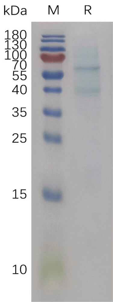 Recomb Mouse BMP6 Protein (6xHis Tag), 50 µg - Luminix Health