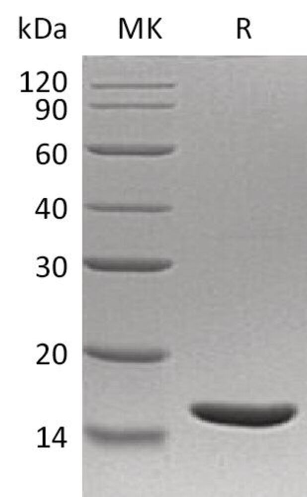 Recombinant Human TNF alpha Protein, 50 µg - Luminix Health