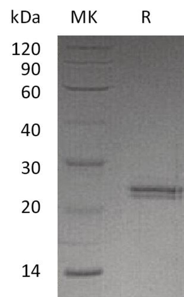 Recombinant Human CNTF Protein, 50 µg - Luminix Health