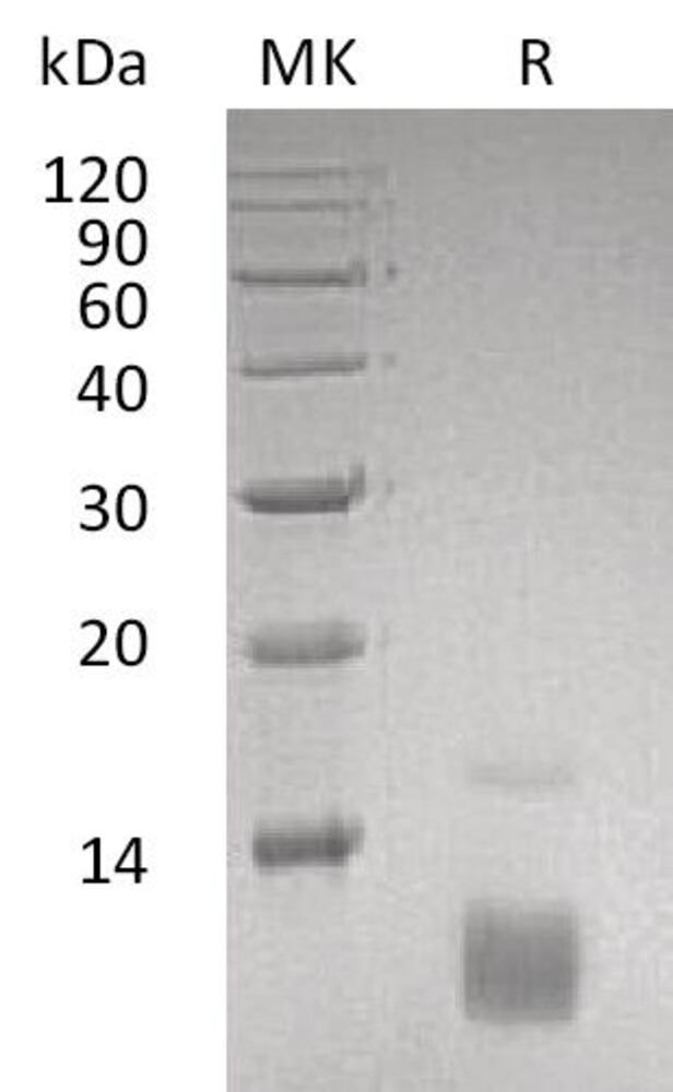 Recombinant Human RANTES Protein, 50 µg - Luminix Health