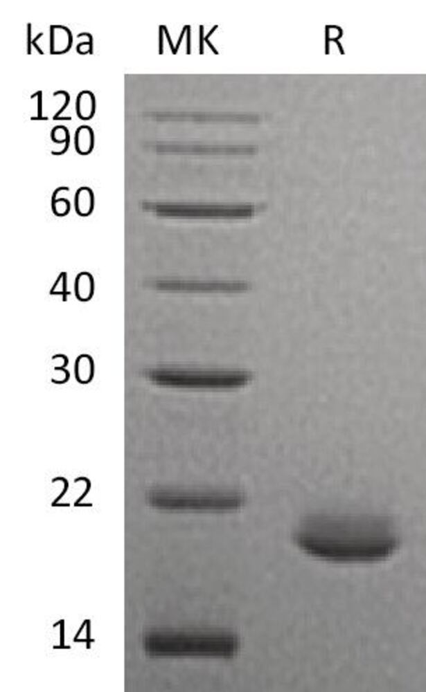 Recombinant Human FGF10 Protein, 50 µg - Luminix Health