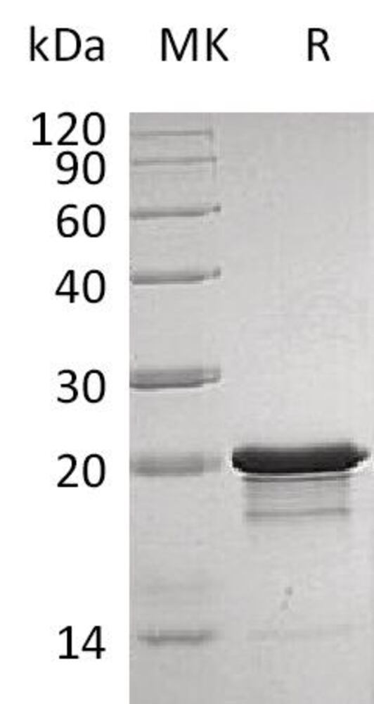 Recombinant Human/Mouse FGF8b Protein, 50 µg - Luminix Health