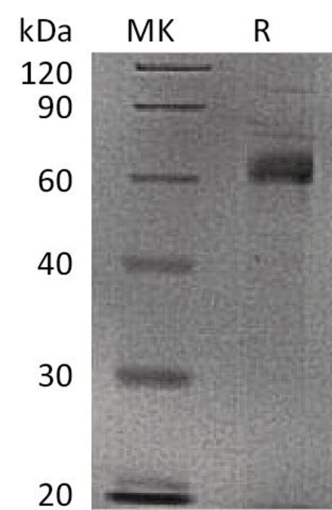 Recomb Human Noggin Prot (Fc Tag), 50 µg - Luminix Health