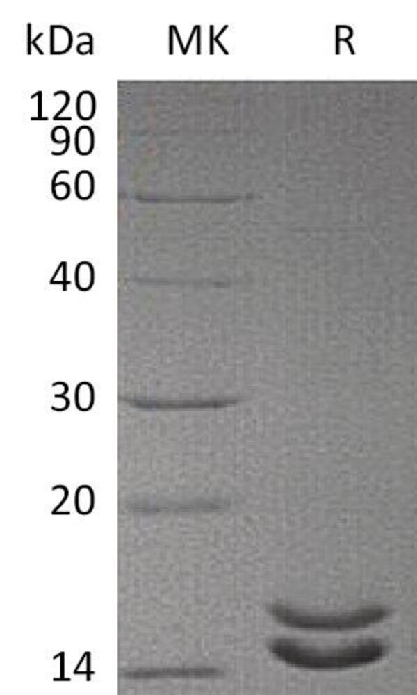 RecHum IL2 Prot(mutated) (6xHis Tag), 50 µg - Luminix Health